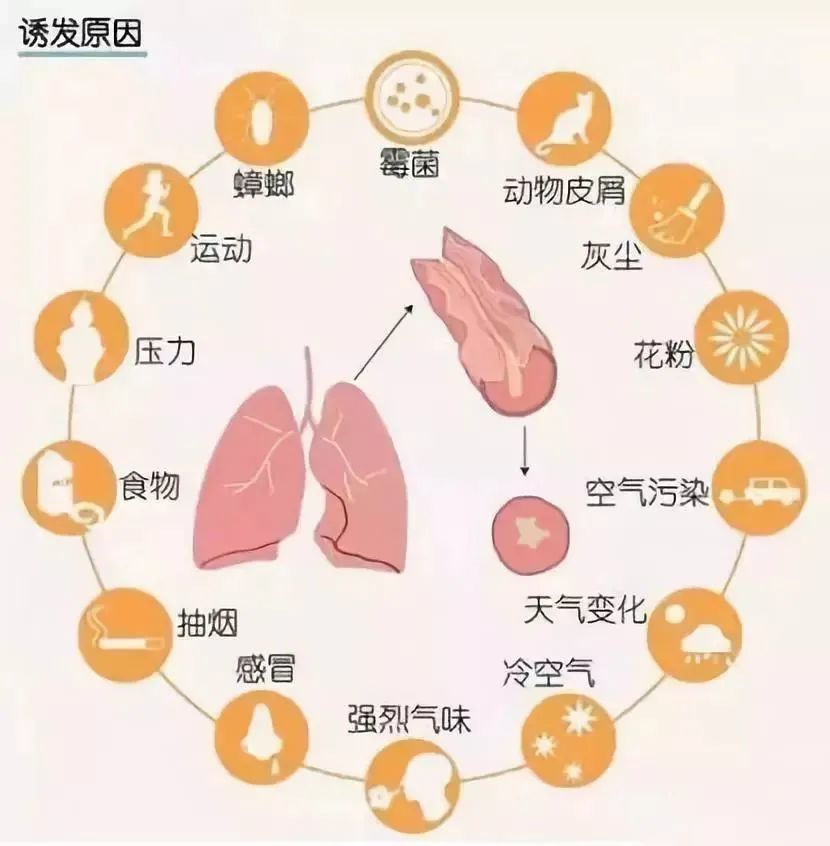 哮喘的发病原因都有哪些？
